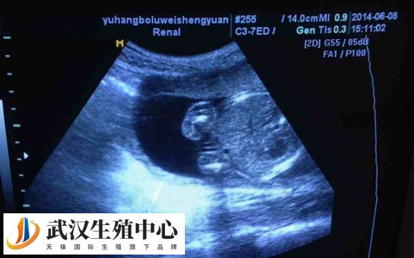 4天卵泡长1mm怎么回事