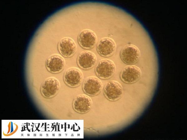 试管助孕期间能不能吃上海青
