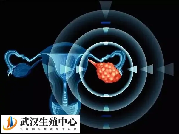 助孕Fsh值高影响卵泡发育原因