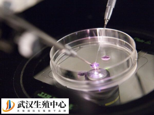 试管移植前要做好心理准备