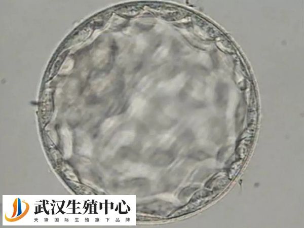 胚胎移植失败有什么预兆