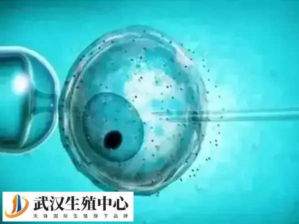 促排卵巢扭转的原因是什么