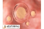 卵泡为什么黄素化